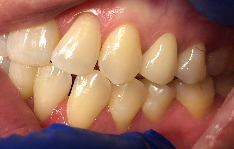Perfect 32 Family Dentistry