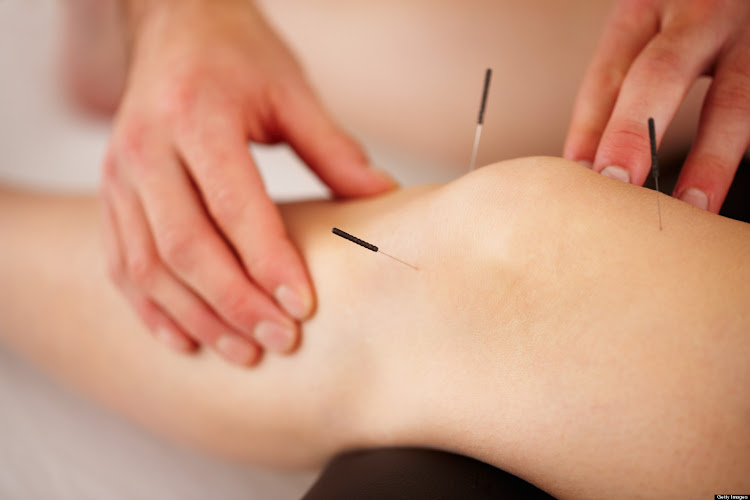 Plano Acupuncture
